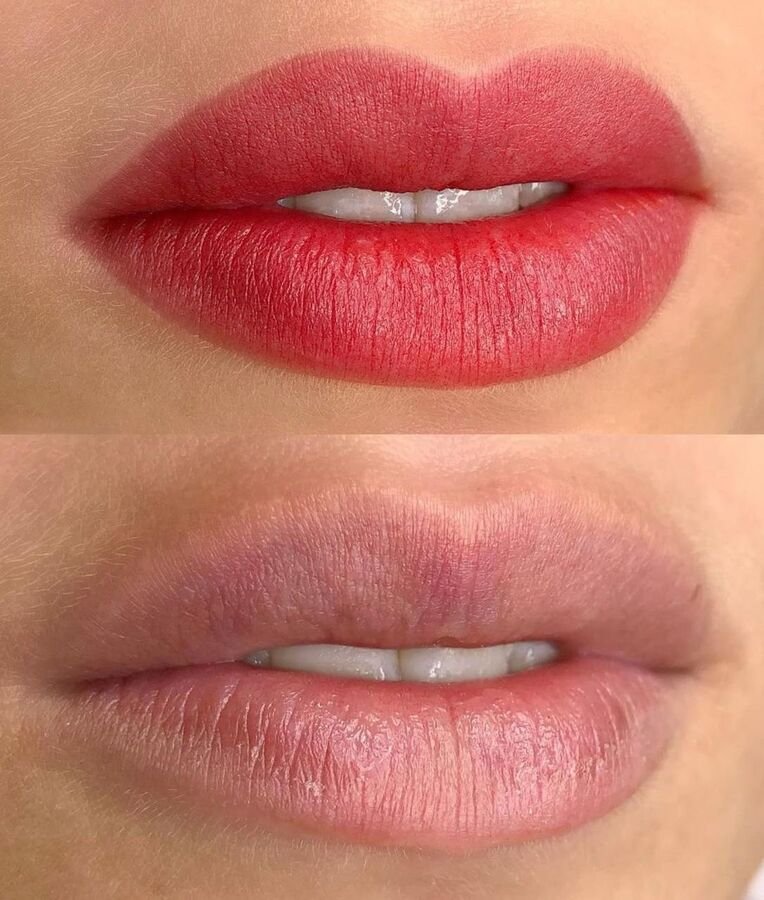 Labios antes y después de micropigmentación